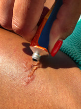 Jellyfish Stings: Separating Fact from Fiction in First Aid Treatment